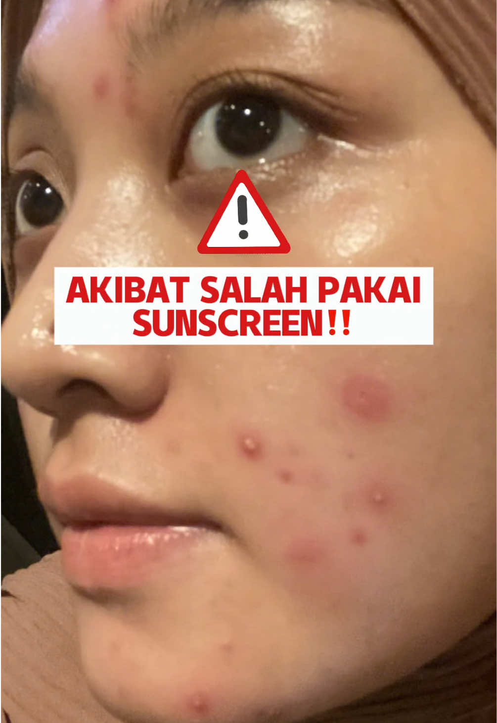 siapa disini yang bingung pakai chemical Apa physical sunscreen?? #sunscreen #sunscreenviral #GRWM🌱 #sunscreenreview 