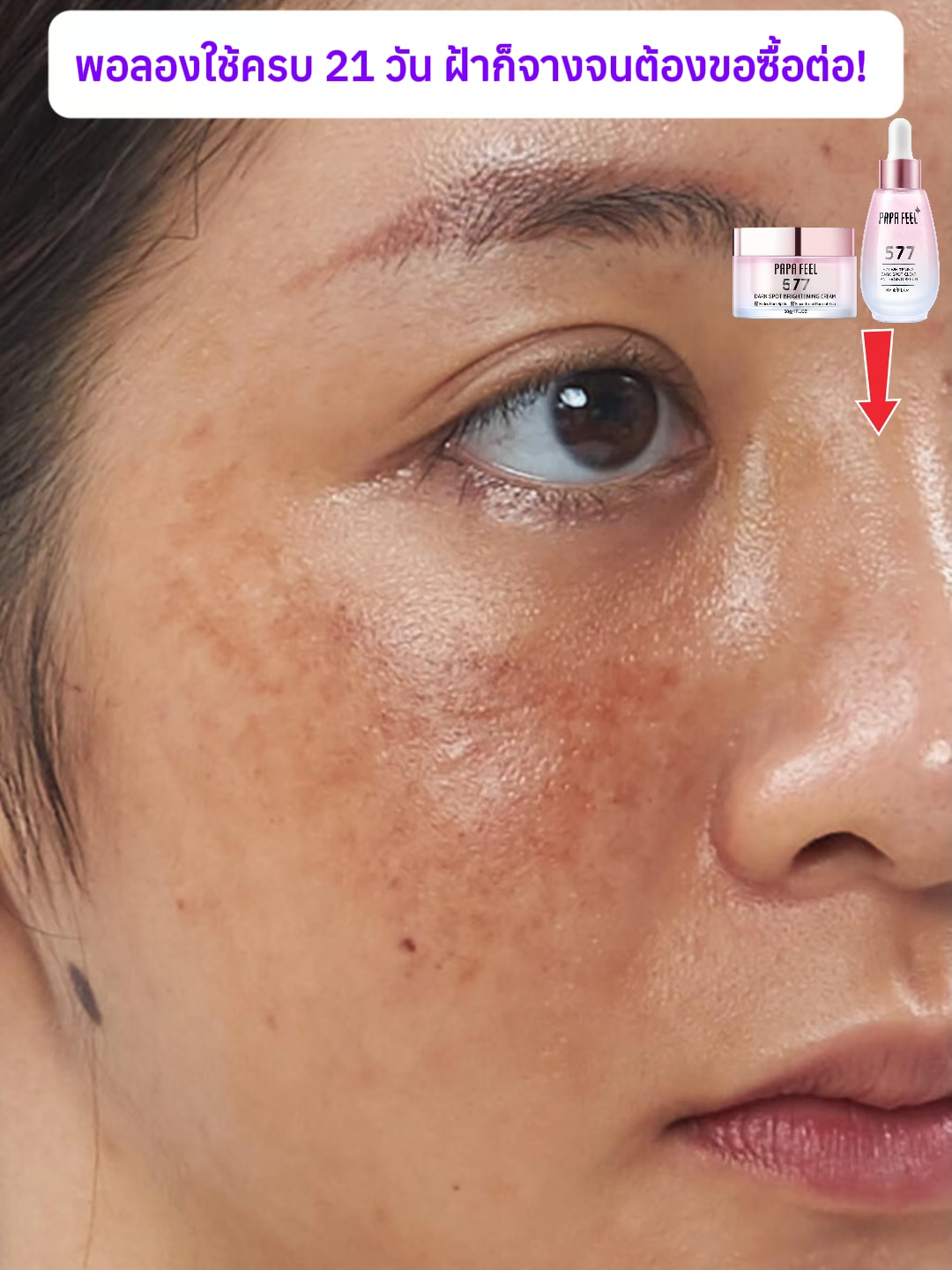 ใช้ต่อเนื่องผิวจะขาวเนียนขึ้น~✨🥰#papafeel#papafeelth#papafeel577#577cream#ฝ้า#ไวท์เทนนิ่ง#รอยสิว