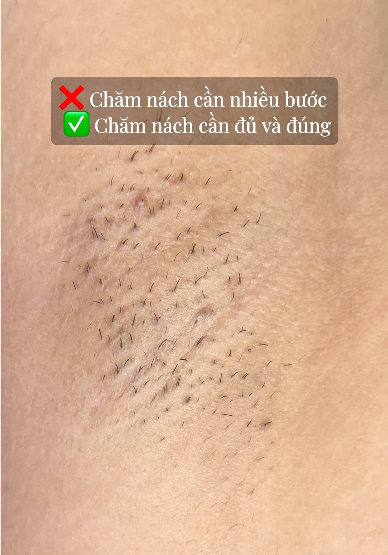 Chăm nách đúng và đủ vì một chiếc nách không lông, không thâm sạm, không sần sùi, mịn màng, trắng sáng ✨  Dala mê chăm những chiếc nách lắm 😘 Cmt 