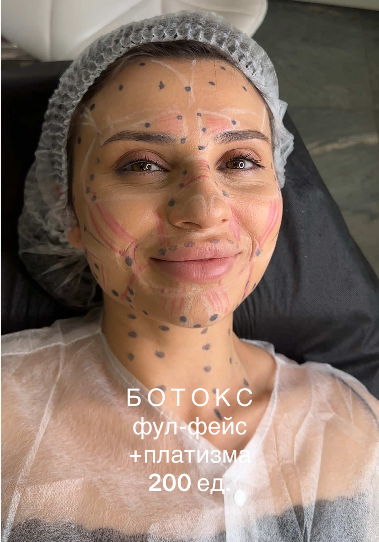 ✨ Ботокс Full Face + платизма — полное обновление лица и шеи ✨ Убираем морщины, расслабляем мимические заломы, придаем шее гладкость и молодость. ✅ Лоб, межбровье, глаза ✅ Носогубные складки и подбородок ✅ Платизма (шея) — без кольцевых морщин и заломов