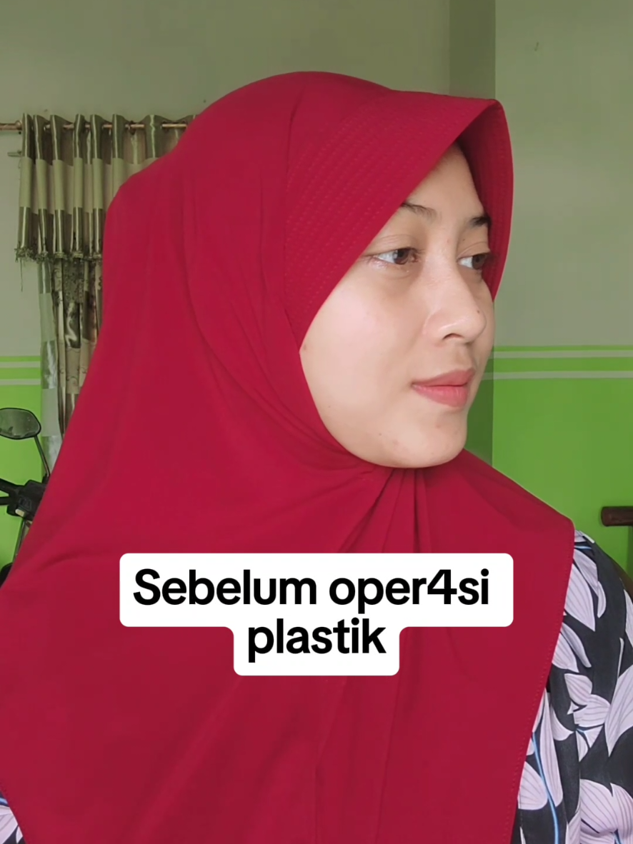 Akhirnya berjalan dengan lancar🤲🥱 #funnycomedy #jelajahindonesia #jangkauanluas #fypreels #reels #mom #Love #fypviral #viralpost #reelspage #trending #fypシ゚  #trandingnews #fypage #lucu #komedi #fyp #tiktok #hiburantiktok #fbpro #konten #parodi #ngakak #tiktokkreatif #tiktokfyp #viral