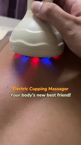Electric cupping device🔥🔥#electriccupping #massage #massagetherapy #cupping #tiktokshop #heating #dealsforyouday #goodthing #fyp 