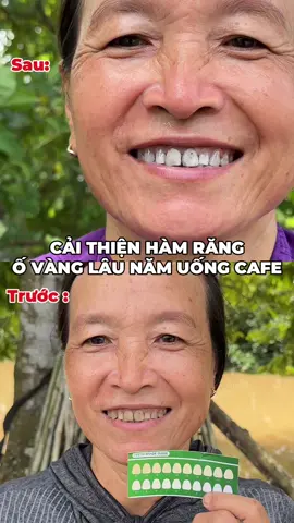 răng vàng quá chị ơi ! nên sài nha c #mqskin #saptrangrang