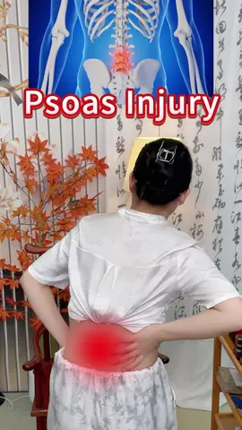 Lumbar muscle strain腰肌劳损#waist #muscle #tcm #fyp #中医 