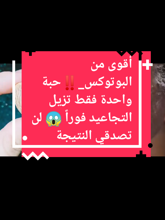 أقوى من البوتوكس_‼️حبة واحدة فقط تزيل التجاعيد فوراً 😱 لن تصدقي النتيجة م#اكسبلوررررر #امريكا🇺🇸 #تفاعلكم #وصفات #اسبانيا🇪🇸_ايطاليا🇮🇹_البرتغال🇵🇹 #الشعب_الصيني_ماله_حل😂😂 #متابعه #متابعه 