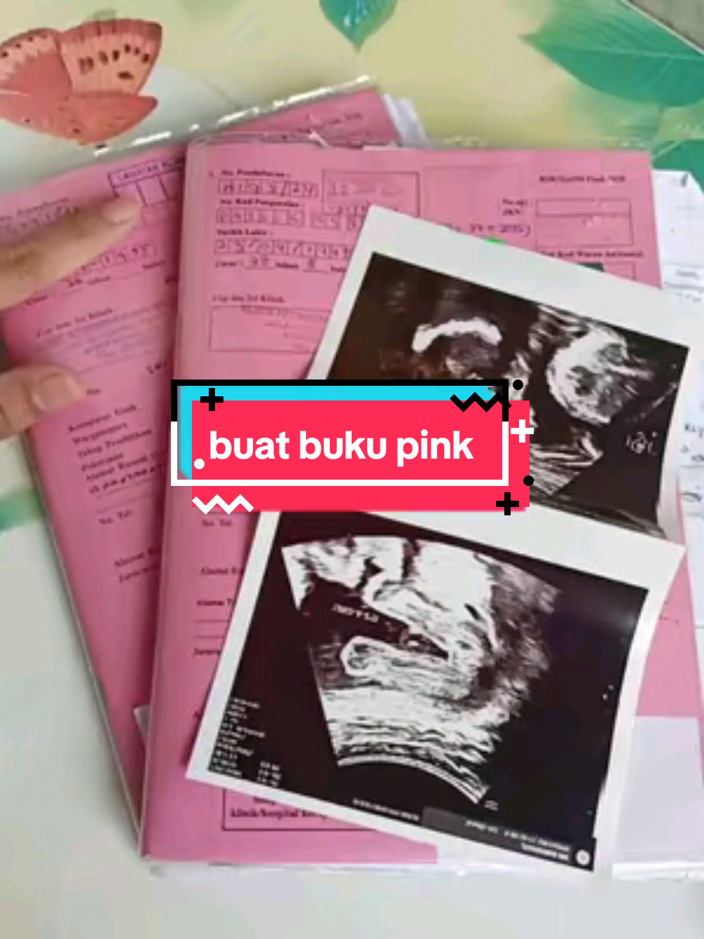 tips untuk mommy yang nk buka buku pink tapi tak tau / tak ingat cara boleh rujuk vidio ini..sehat selalu mommy .semoga membantu #bukabukupink #babyboy #babygirl #babytwin #newparents #newmom #malaysia #