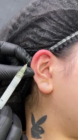 Đầu tháng mới làm tí tai tài lộc nhẹ nhàng nha mong tháng mới hanh thông 🥰🥰🥰 #tiêmFillerranhcuoi #fillers💉 #Tiêmfiller #FillerUyTin #haiphong 
