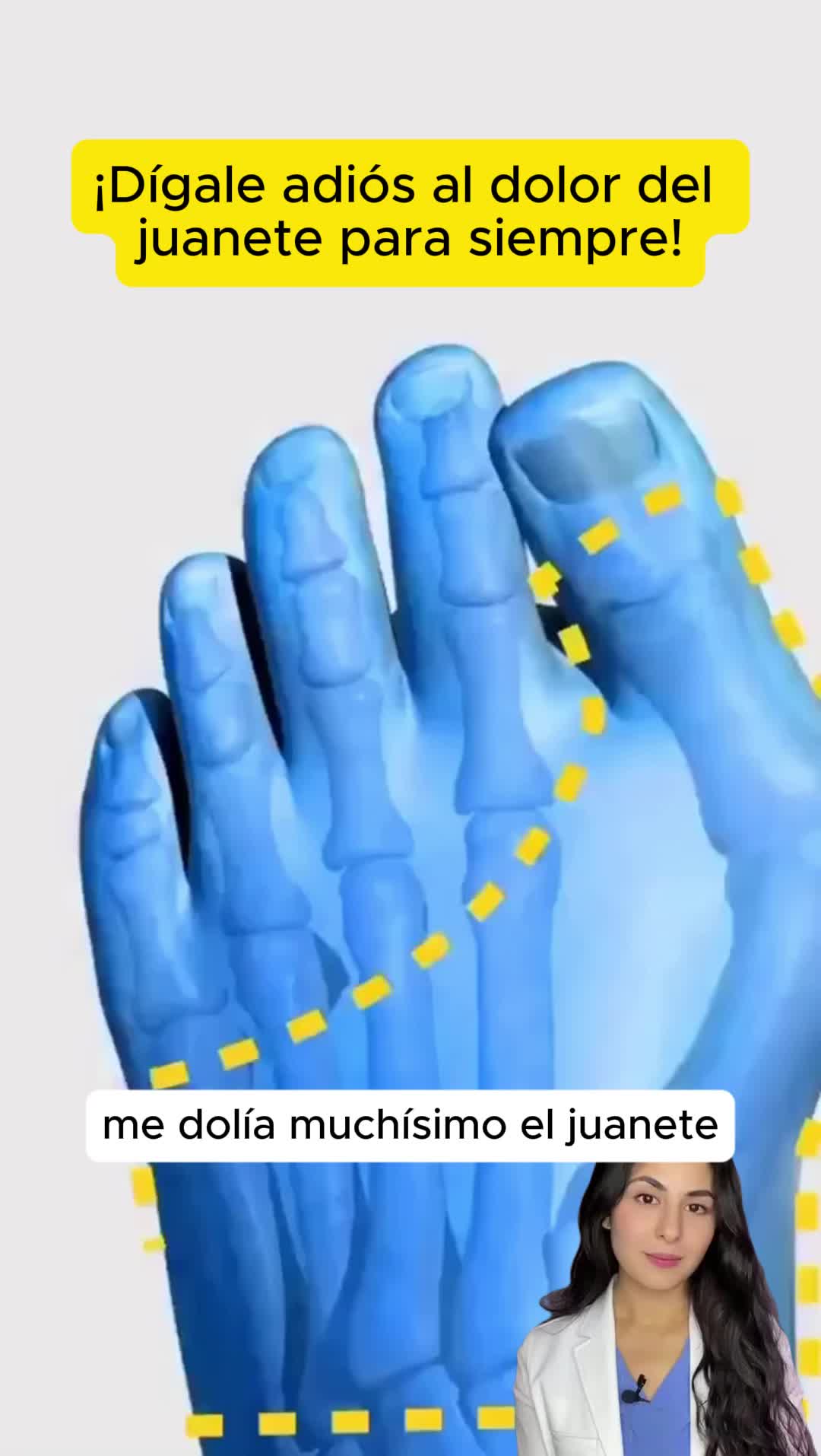 ¡ALTO A LOS JUANETES! ✋😥 Elimina dolor, evita cirugías y SALVA TUS PIES. Nuestro corrector da alivio AL INSTANTE + alinea dedos. Camina cómoda con TODOS tus zapatos 👠✨ ¡Previene riesgos de amputación!  #footcare #shoecare #pedicurekit #pedicuretools #pedicureathome #foottreatment #footcomfort #footcareessential #athomepedicure #shoedesign #bunioncorrector #footcareessentials #JuanetesAdios #CuidadoDePies #PiesSinDolor #CorrectorDeJuanetes #SaludPodológica #PedicuraEnCasa #TikTokLoRecomienda #TikTokShopFinds #ProductoMilagro #BienestarPodológico #TikTokMadeMeBuyIt #MustHaveGadget #PainFreeLife #footwellness