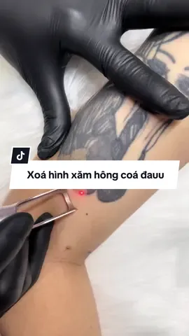 Hình xăm hông còn ưng ý 😣 nhắm mắt đi xoá luônnnn #viral #phunxamminhnguyet #xoahinhxam #laserhinhxam #longthanh 