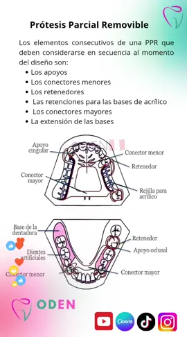 de prótesis parcial, es importante identificar las partes de un RPD y sus funciones, es por eso que compartimos esta infografía contigo Retenedor Dientes Apoyo oclusal Diseño de prótesis parcial removible. David Loza Fernández, Rodney Valverde Montalva. Ed Conector mayor Ripano.2007 de talva Ed Rig hang, Daniela Kratochvil's Fundamentos de prótesis parcial removible. Ting-Ling Chang, Orellana y John Beumer. ED Quintessence Publishing. 2019 #enfermeria #anatomiadental #conocimiento #tips #estudiantes #odontologia 