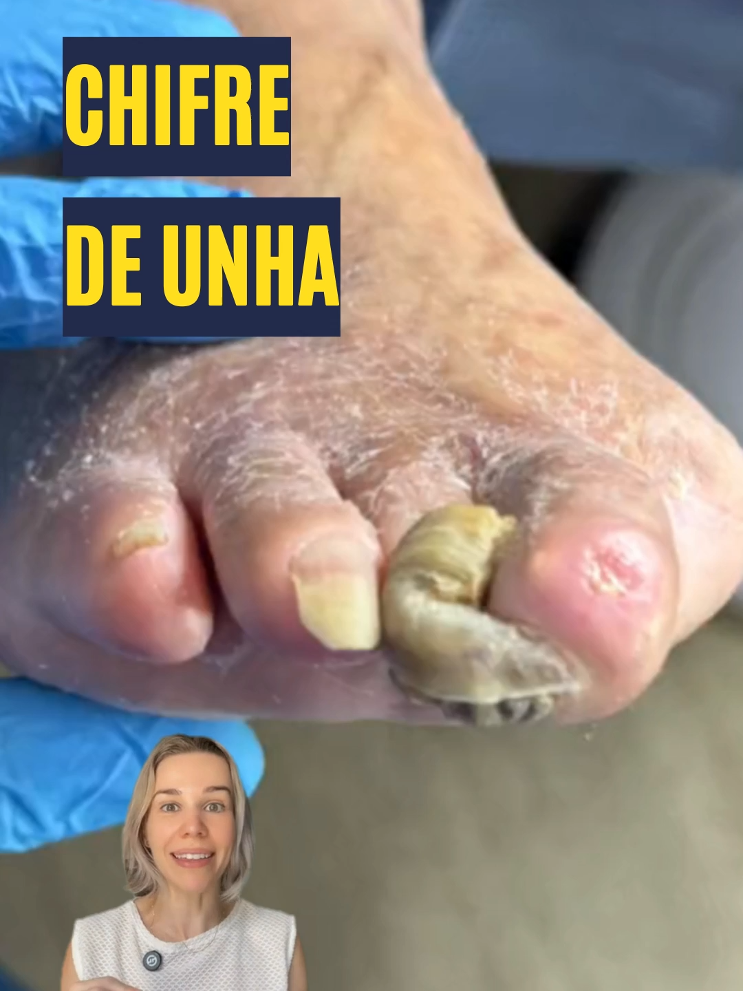 Unhas Gigantes São Um Problema?😰 #ciência #saude #curiosidades #medicina #dicamédica #educação