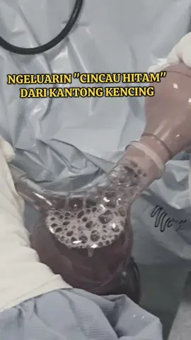 NGELUARIN 
