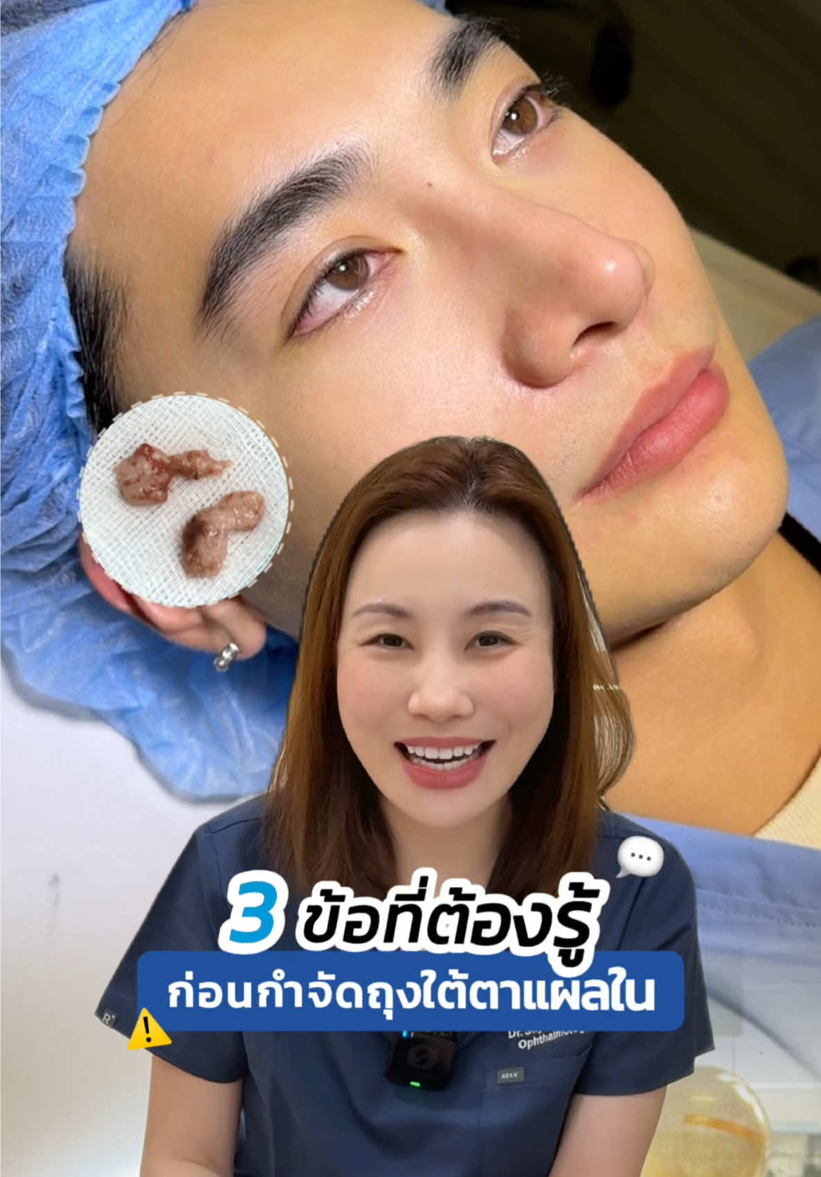 3 ข้อที่ต้องรู้ก่อน #กำจัดถุงใต้ตา แผลใน ‼️ #หมอสกาย #skyclinic #จักษุแพทย์ #รีวิวกำจัดถุงใต้ตา #สกายคลินิก #babylock 
