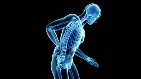 Lower back pain is one of the top reasons people visit orthopaedic clinics. Here’s a simplified animation to explain why #orthopaedic #spine #backpain #medical #doctor  