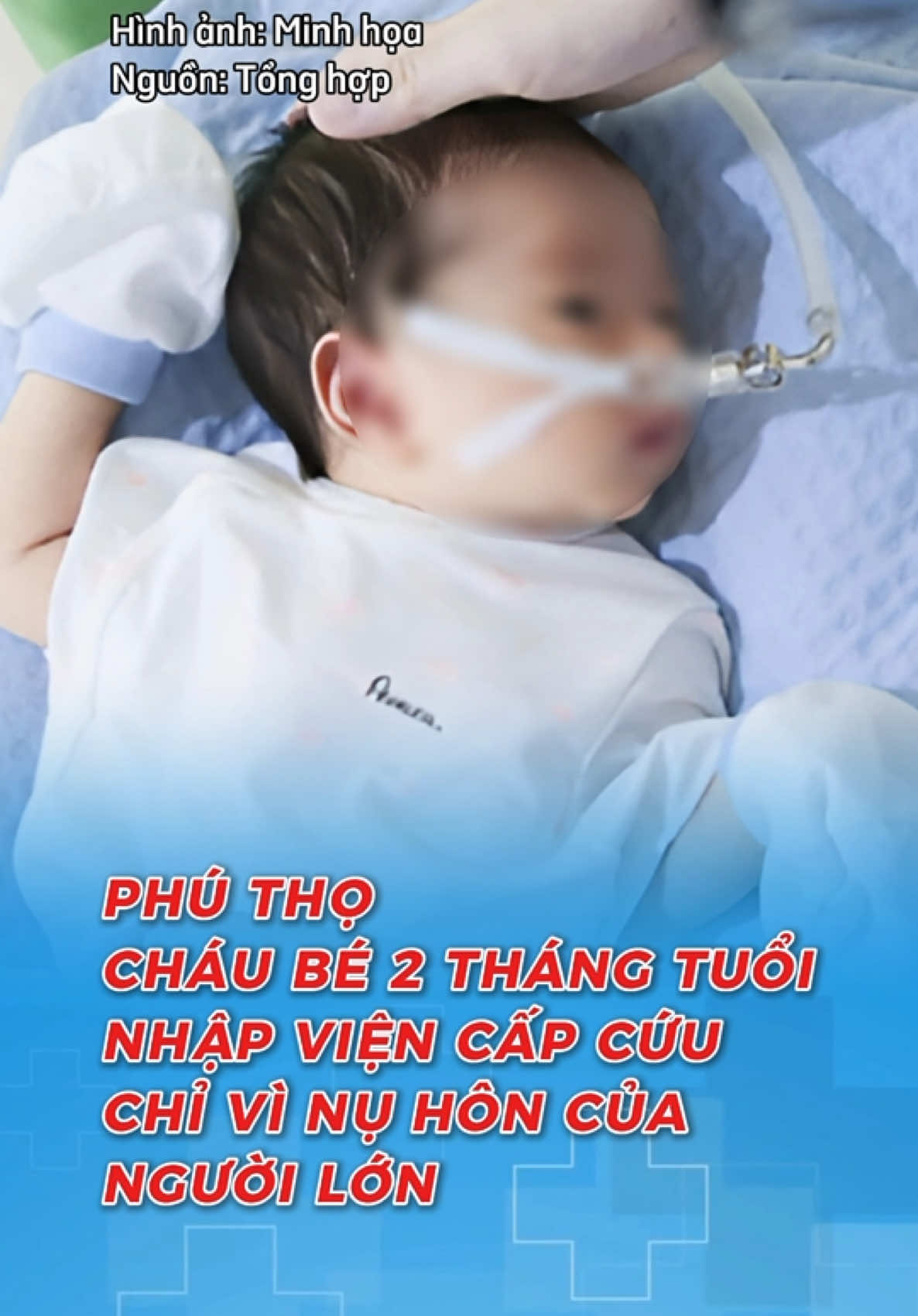 Thể hiện sự yêu thương trẻ sai cách là nguyên nhân dẫn đến việc cháu bé 2 tháng tuổi s.uy hô hấp phải nhập viện cấp cứu #mevabe #chamconkhoahoc #atlanticmedical #suckhoe #songkhoe247 #xh 