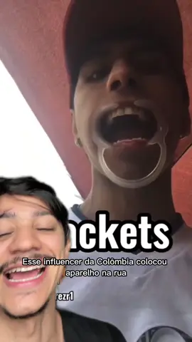 Ele colocou Aparelho na Rua, mas não esperava que…#aparelhofake 