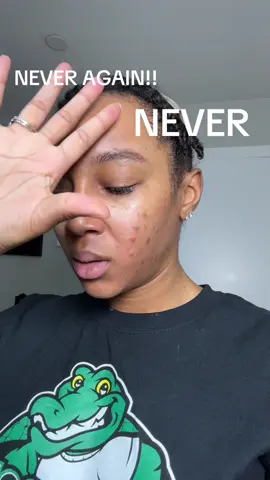 Y’all don’t even understand the disappointment in my heart right now 😩 #acnetreatment #why #acneproneskin #review #help #pimplepatches #fail #ugh #brijohnson212