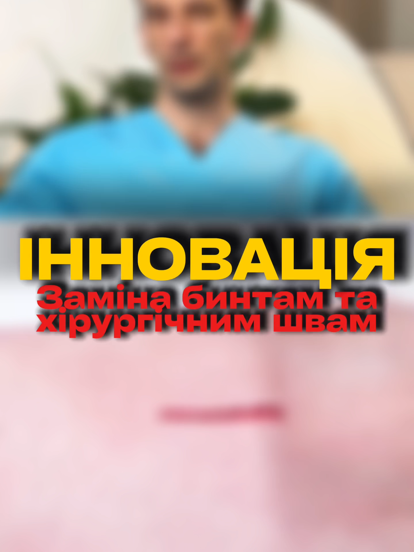 Забудьте про шрами та біль від швів! Студенти з США створили бинти майбутнього — вони буквально «запечатують» рани без хірургічного втручання. Просто прикладаєш до порізу — і тканина починає гоїтись без сліду. Так, тепер навіть із серйозною колото-різаною раною можна не їхати до лікарні. ⠀ 💥 Це вже не фантастика, а нова реальність медицини. 💬 Як гадаєш, скоро в кожній аптечці буде такий бинт? Записуйтеся на консультацію через директ (@dr.panch) або приватні в ТТ. 📲 +38 (095) 323 6464 📍Харків, Вінниця #мамопластика #абдомінопластика #блефаропластика #ліпосакція #ліпофілінг #пластичнийхірург #пластичнийхірургхарків #пластичнийхірургвінниця #пластичнаоперація
