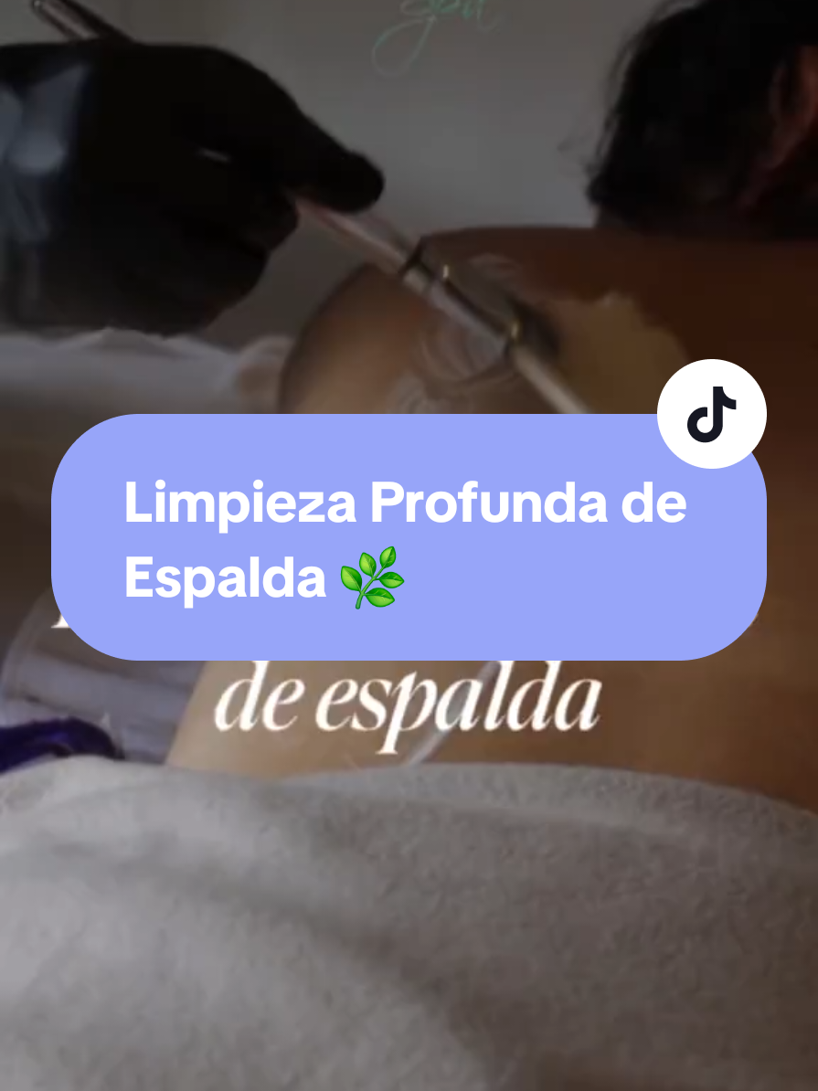 ✨ ¡Tu espalda también merece cuidado! ✨ Este mes en Maras Spa consiéntete con una limpieza profunda de espalda y disfruta de un 20% de descuento. Elimina impurezas, combate el acné y luce una piel suave y radiante. 💆‍♀️💫 📍 Solo por tiempo limitado 📲 Agenda tu cita por mensaje directo #MarasSpa #LimpiezaDeEspalda #SkincareCorporal #DescuentoEspecial #SpaTime #PielSaludable #RelaxTotal 