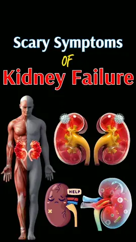 Scary symptoms of kidney failure #kidney #kidneydisease #kidneyfailure #kidneystone #kidneys 