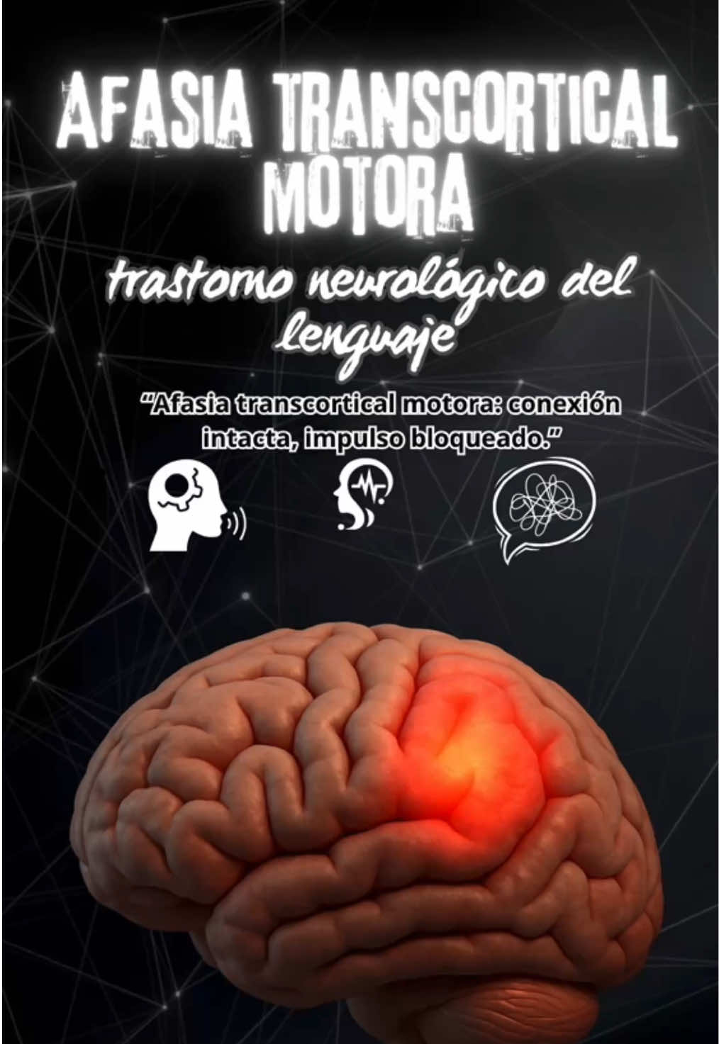 🧠 ¿Puedes repetir todo lo que escuchas pero no iniciar una conversación? 🗣️ Eso puede ser afasia transcortical motora, un raro trastorno del lenguaje que deja intacta la repetición, ¡pero bloquea el habla espontánea! 😮🧩 🧬 El cerebro es tan complejo como sorprendente… 📍Conócelo, compártelo y cuida tu salud cerebral. ⁠ 🔎 ¿Ya lo habías escuchado? ¡Síguenos en nuestras redes sociales! 📲👇 https://linktr.ee/medikalmuneris #Afasia #Neurociencia #Lenguaje #CerebroHumano #Neurología #TrastornosDelLenguaje #CuriosidadesMédicas       