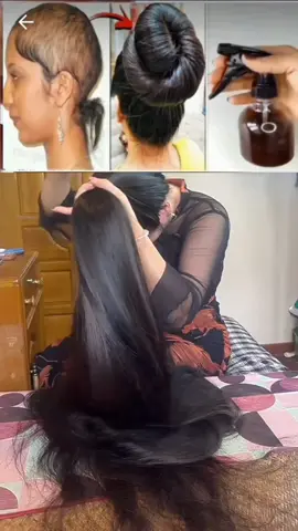 Hair Loss and Regrowth Spray 