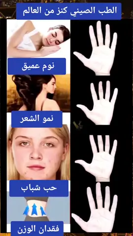 #العلاج_الطبيعي #الصيني #tiktok #CapCut #اكسبلور 
