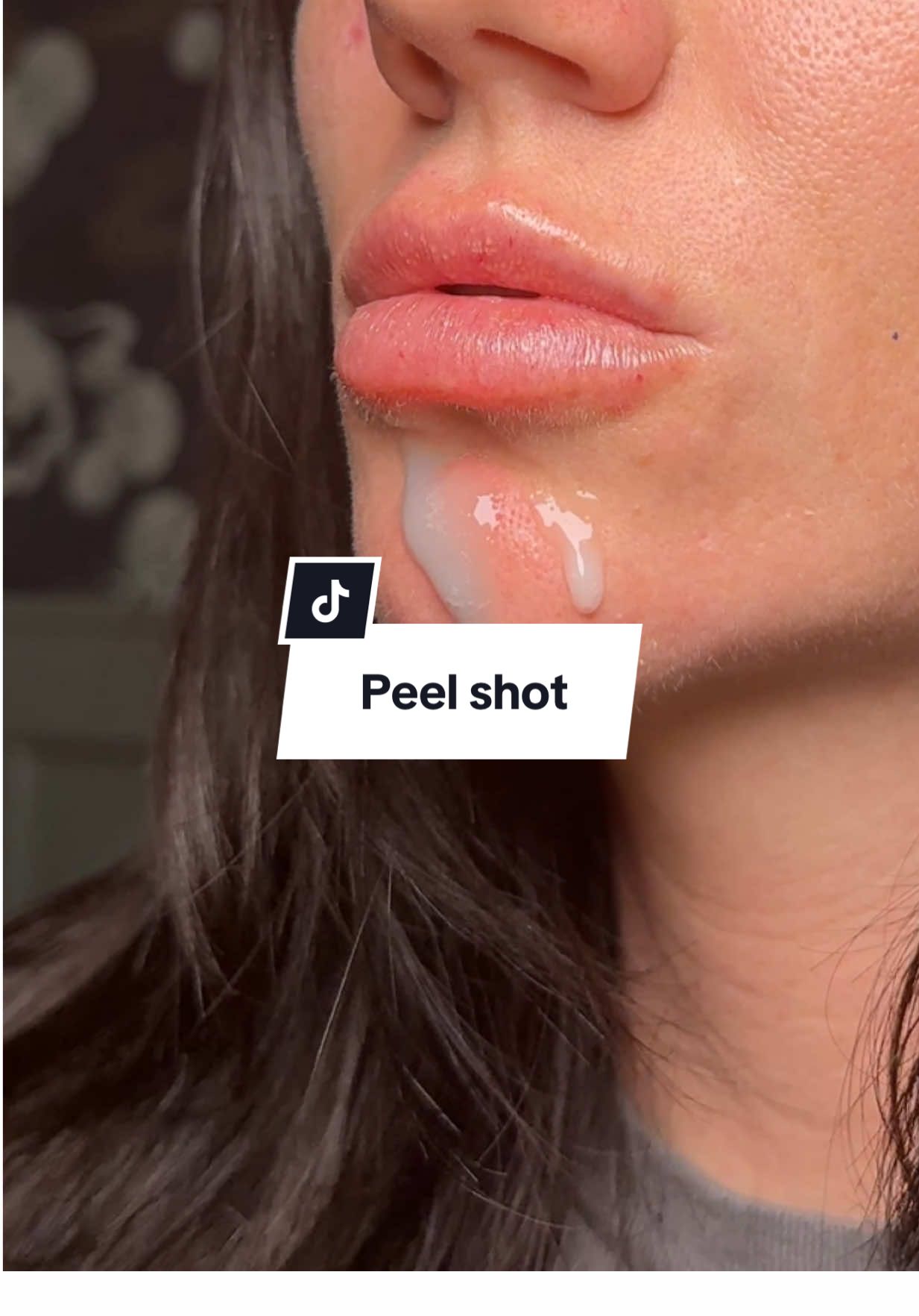 Replying to @Claire 🧸 we are getting real close and personal #drmelaxin #peelshot #exfoliante #pore #porecontrol #whiteheads #blackheads #sebum #koreanskincare #skincare #ttsdelight #tiktokshopcreatorpicks  #tiktokshoprestock #toptierjuly  #tiktokshopcreatorpicks  #titkokshopbacktoschool #tiktokshopblackfriday #tiktokshopcybermonday 