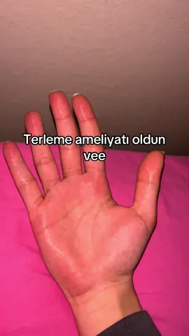 hayatım degisti  #ets #hiperhidrosis #ameliyat #keşfet #fy #ter #viralvideo #sevgili 