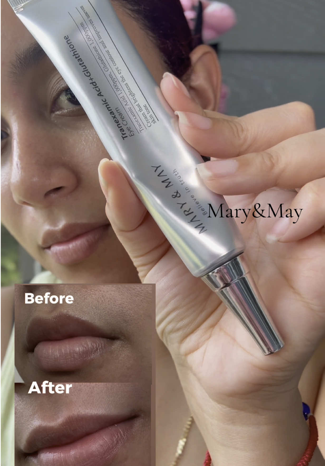 14 days. Real results. Bye bye hyperpigmentation 👋✨ @Mary&May Official  #marynmay #marynmaypopchallenge #eyecream #kbeauty #txa #tranexamicacid #glutathione #hyperpigmentation