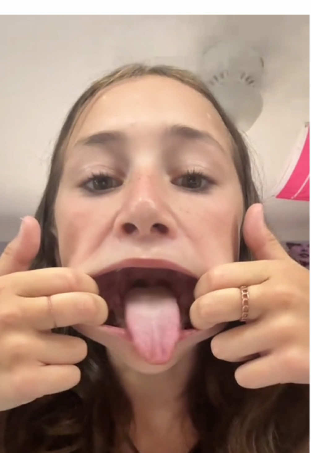 who doesn’t love this trend? #bops #tongues #braces #magic #mouth#CapCut 