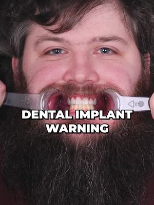 Permanent Teeth are 24hrs Away!