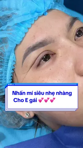 Nhấn mí siêu nhẹ nhàng   Cho E gái 💕💕💕#Tuyết_Diamond #videoviralitiktok #xuhuong #Mí_đẹp #nhấn_Mí_tự_nhiên #nhấn_Mí_tự_nhiên 