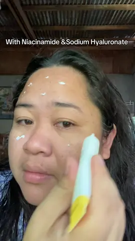 Whitening and Freckle Removing Cream #vgo #whitening #freckles 