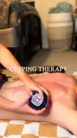the only thing that has relieved my husbands back pain after all these years😅 HIGHLY recommend 🙌🏼 #SmartCupper #REVOrelief #TikTokMadeMeBuylt #ViralProduct #PainReliefTool #CuppingTherapy #RedLightHealing #SuctionTherapy #WellnessHack #HomeRecovery #SoreMuscleSolution #FitnessRecovery #GadgetGoals #RelaxAtHome #momlifehack  