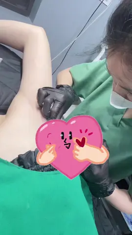 Tiêm trị tuyêns mồ hôi nách ạ