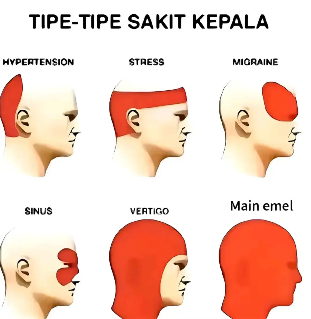 cerita nya gini dia bacotan nya bnyk. jadi dia kami lock. suruh beli buku buat belajar malah beneran di beli. 😭😭#promoseruweekend #trending #xyzbca #tiktok #vypシ✌️❤️ #4upage #MLBBALLSTAR 
