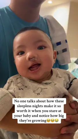 Ang bilis mong lumaki anak😭🥹 #pinoynz #pinoynz🇳🇿🇵🇭 #newzealand #cleftstrong #cleftlip 
