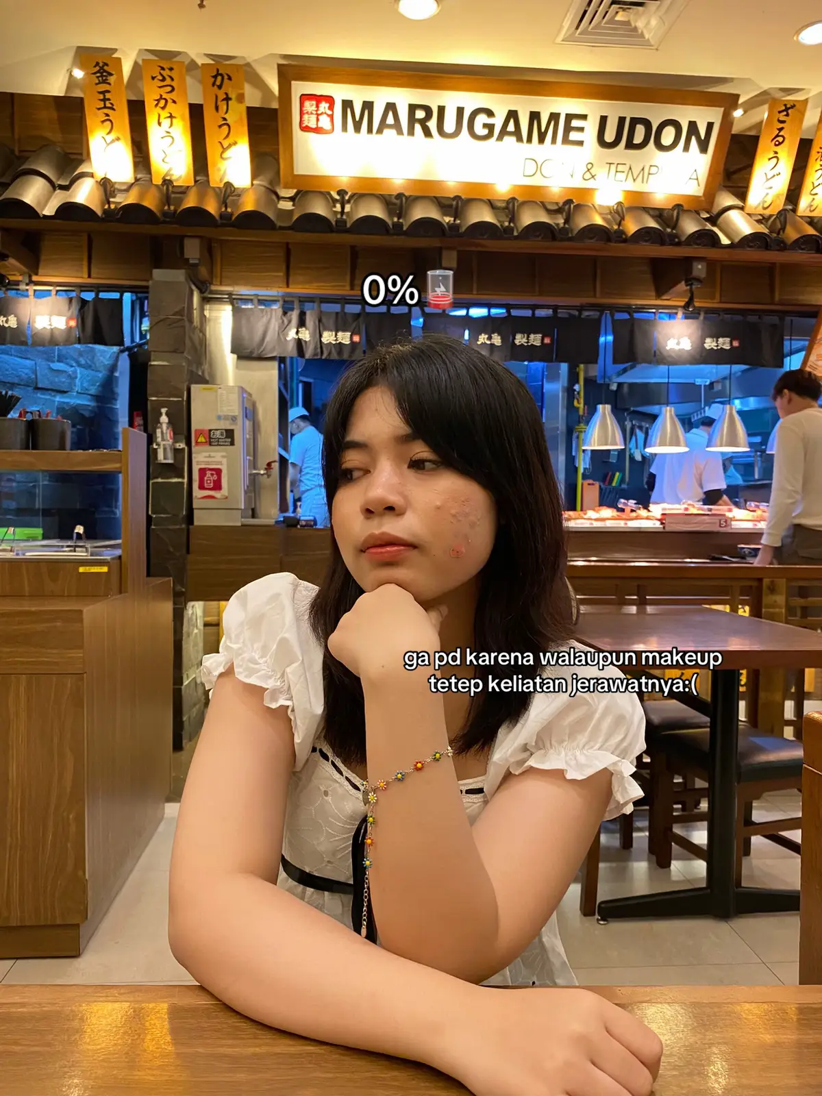 ga instan si tpi perubahannya sangat signifikan, sama note jangan sering begadang yaa🫶🏻 #acnefighter #acne #acnesolution #scars #pie #pih #GlowUp #serumviral #shineglow #glowing #fyp #perubahan #totoljerawat 