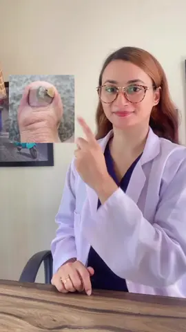 #skintok #fungaltoenailtreatment #eczema #skinrash #creatorsearchinsights #rxiqra #medicinal_info_by_iqra #koreanskincare #clearskin #whitening #whiteningcream #glassskin #skincareroutine 