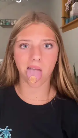 let this trend never die. #bops #tongues #braces #magic #mouth #CapCutFamília #CapCutAmor 