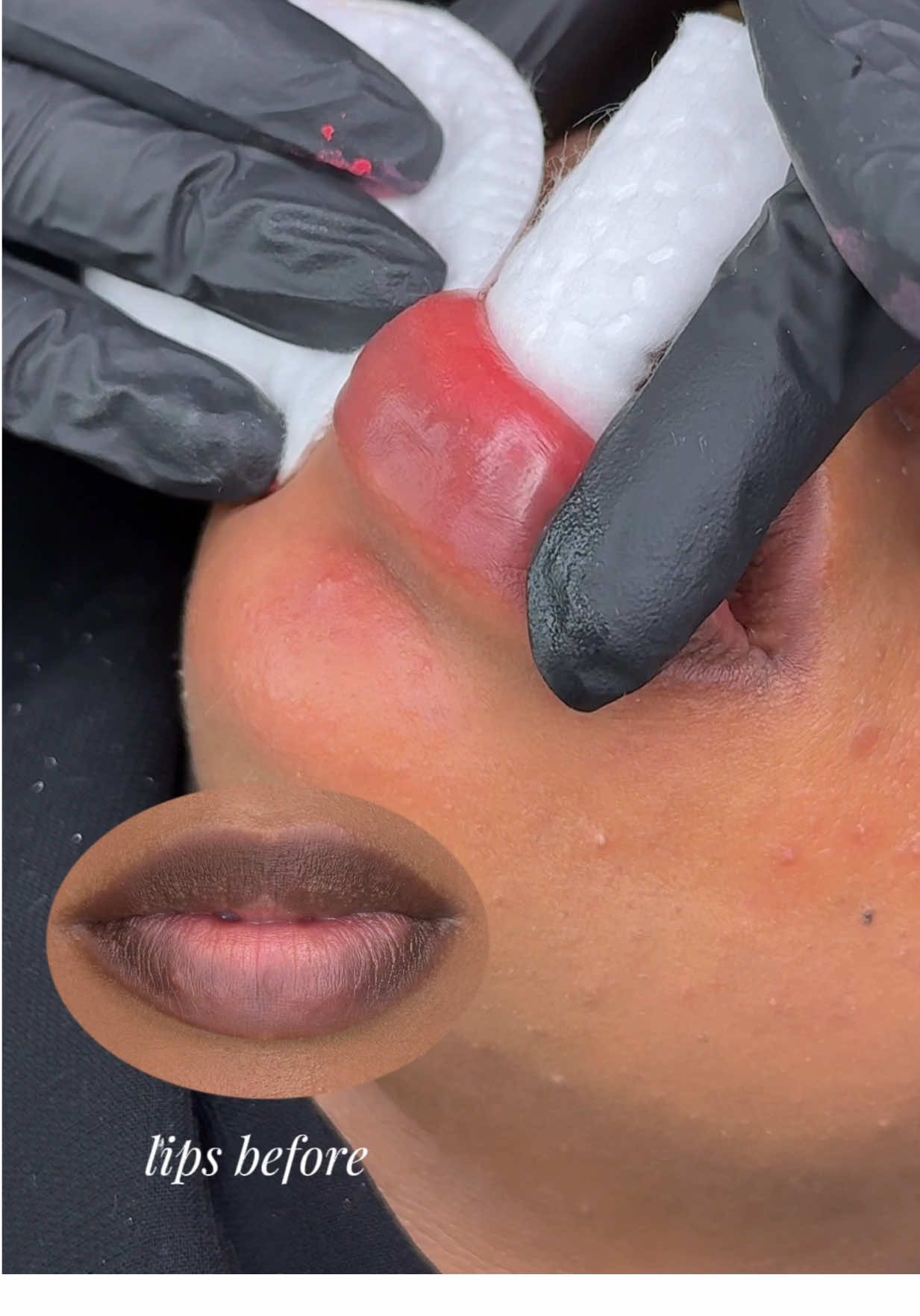 🎥 Watch the transformation! I’m shading dark lips in this clip — wait till the end to see how beautifully the color is neutralized 💋 This technique changes everything for clients with hyperpigmentation. ✨ Want to learn how to do this? Next Lip Blush Training: 📍 August 12–13 — only 1 spot left 📍 September 20–21 — advanced training DM to apply or ask questions 💌 #lipneutralization #darklipscorrection #lipblushtraining #pmutraining #lipblushing #pmuartist #lipblushtutorial #beforeandafterlips #permanentmakeuptraining #beautybusiness #pmucommunity #pmucoach #lipcorrection #lipshading #melaninrichlips #watchtilltheend #capcut   