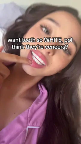 this gel is the only thing that gets my teeth insanely white !! white teeth on a budget 👁️🦷🦷👁️ #teethwhitening #teethcare #braces #veneers #whiteteeth #opalescence 