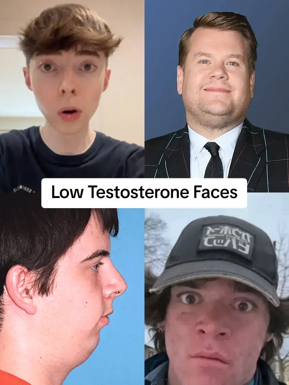 Puberty is a crucial time in your facial development. Your testosterone plays a major role in your facial appearance even throughout adulthood. Build healthy and testosterone friendly habits with 