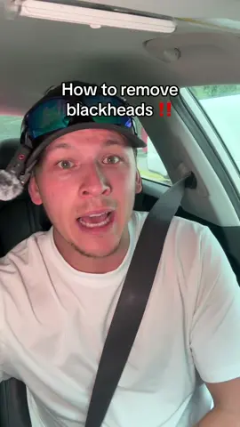 and they’re on sale 😭 #koreanskincare #skincare #skindetox #beplainskindetox #tiktokshopcreatorpicks #tiktokshopbacktoschool 