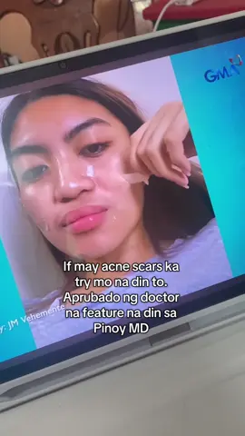 For acne scars at keloids to mga mare #siliconescarsheets #acnescars #keloids 