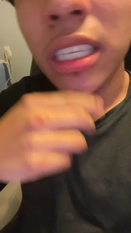 #fyp #whiteningstrips #viral #whiteteeth 