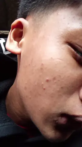 #fyppppppppppppppppppppppp #forme #tiktok The face has a lot of wrinkles.  bugasog nawng