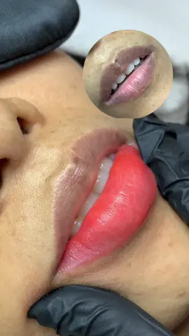 Mấy bà thấy sự khác biệt hong 💕 #fyp #NhungDangBeauty #phunmoitunhien #khuthammoi #phunmoibinhthanh #ilovetiktok 