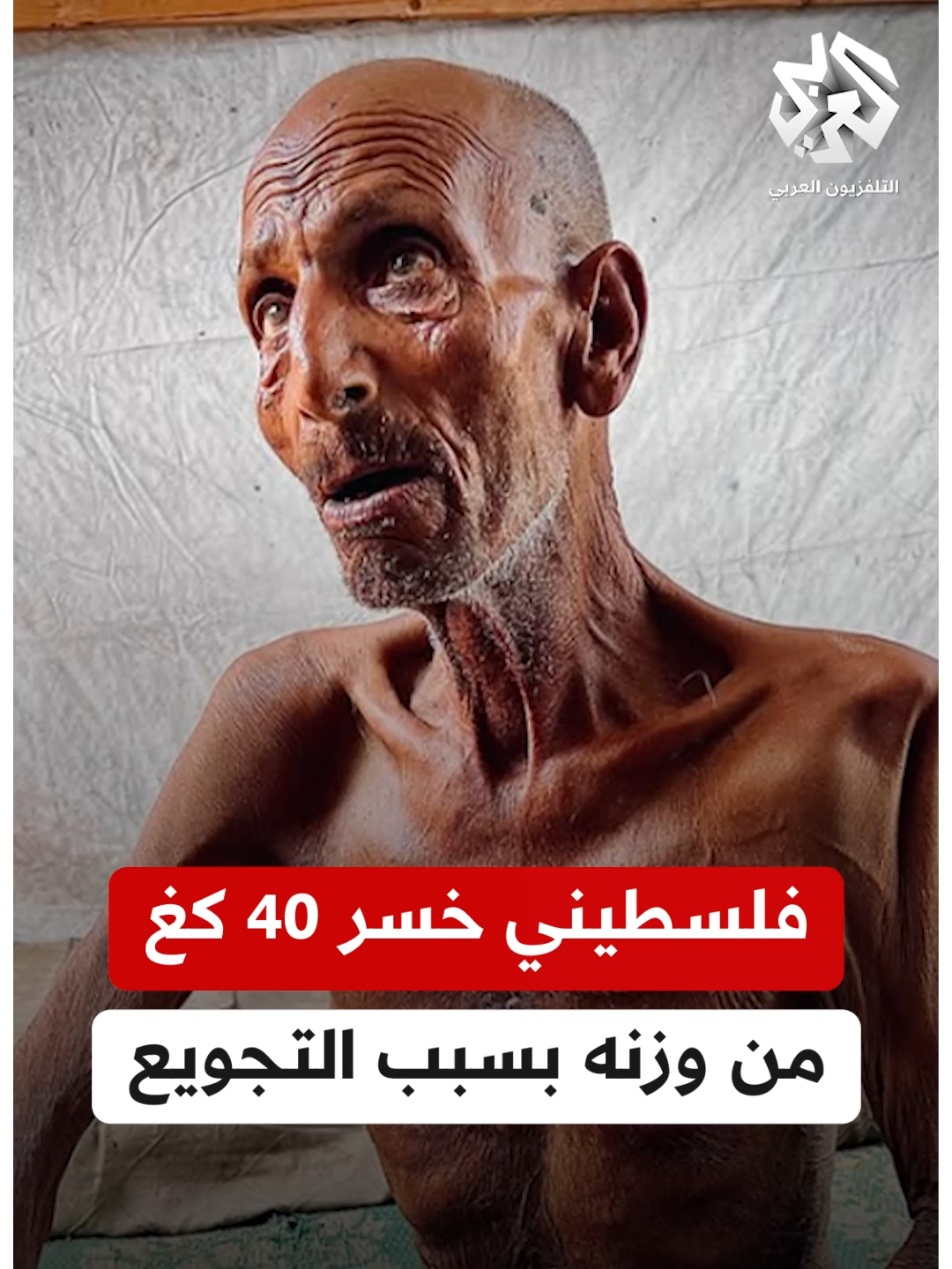 خسر نحو 40 كغ من وزنه.. مسن فلسطيني يعاني من التجويع بسبب حصار الاحتلال على #غزة #التلفزيون_العربي #أخبار